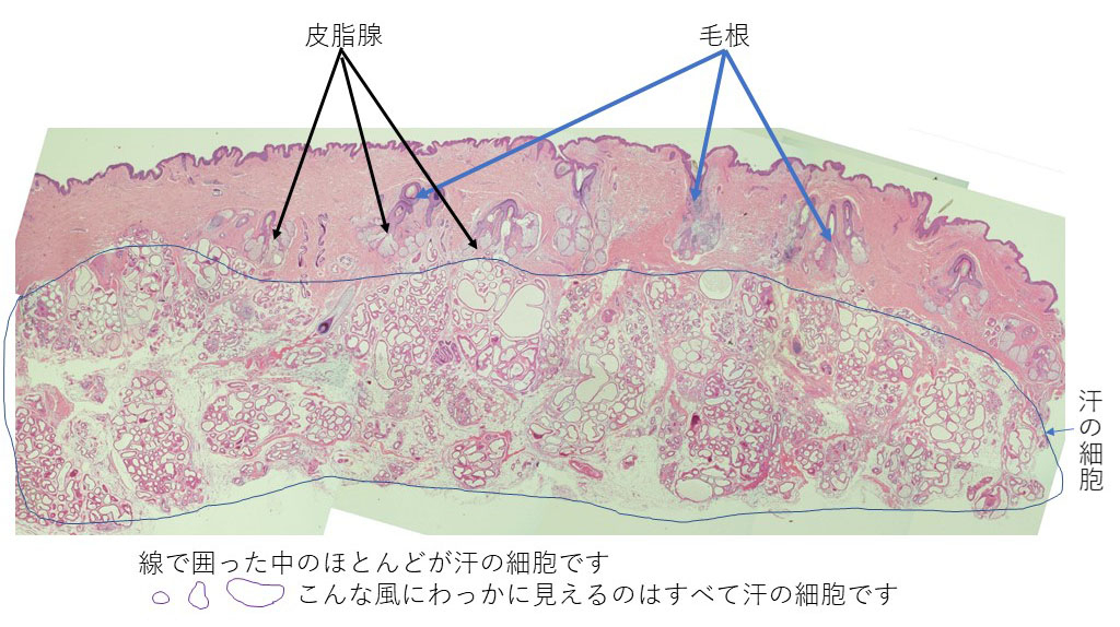 わきの下の皮膚