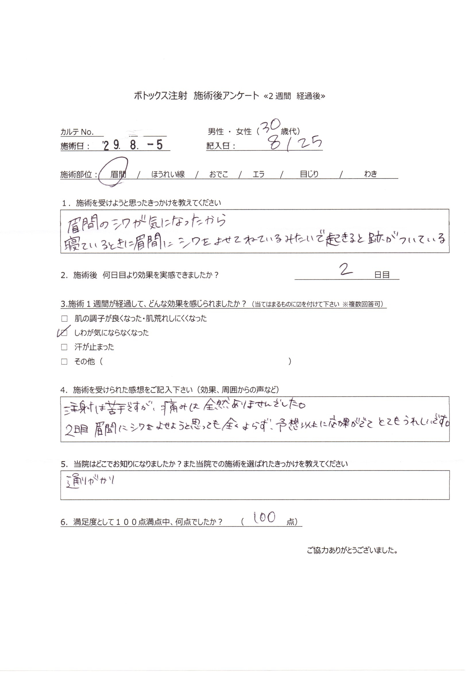 ボトックス注射